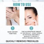 Eelhoe Dark Spot Remover Cream, Eelhoe Dark Spot Cream
