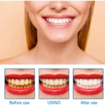 EELHOE Teeth Whitening Essence