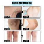 Eelhoe Whitening Cream